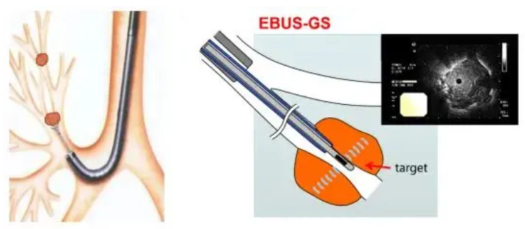 ab.png